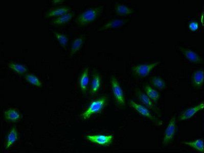 GHITM Antibody