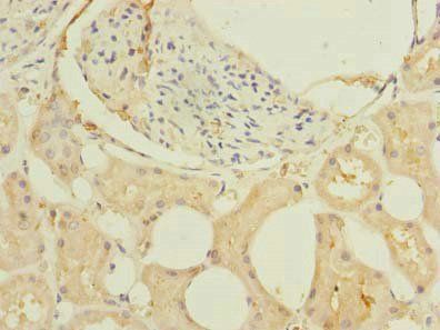 GHITM Antibody