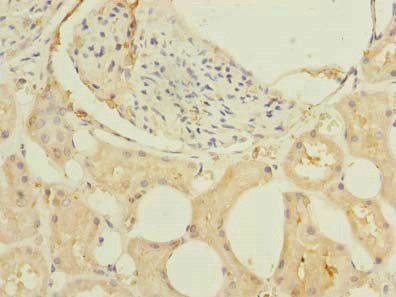 GHITM antibody