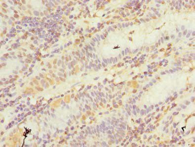 GHITM Antibody