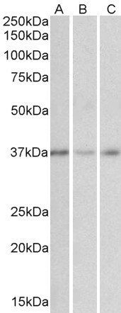 Goat anti-MICS1 / GHITM Antibody