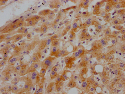 GHR Recombinant Monoclonal Antibody