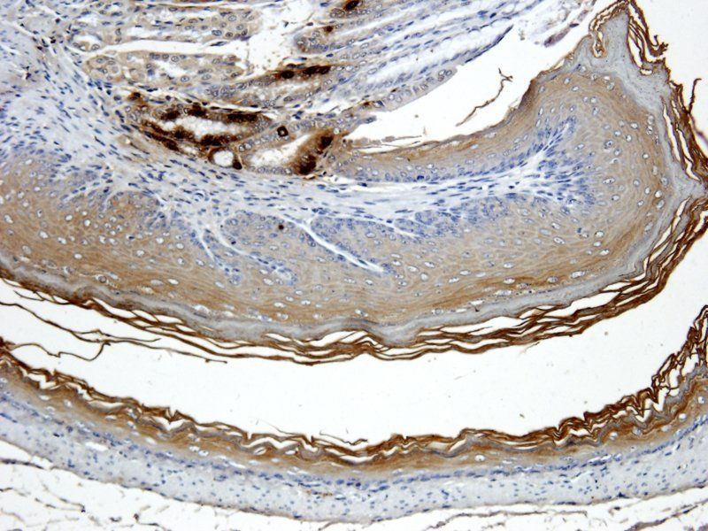 Ghrelin antibody