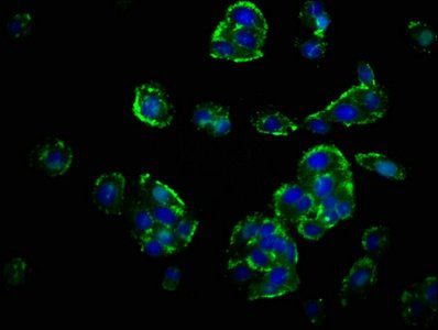 GHRHR Antibody