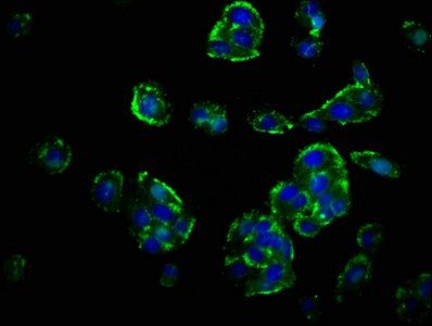 GHRHR antibody