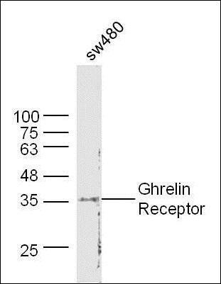 Ghrelin Receptor Rabbit Polyclonal Antibody
