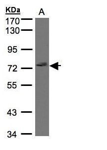 LIMCH1 antibody [C2C3], C-term