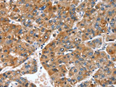 GINS1 Antibody