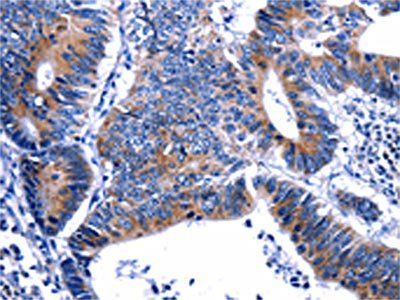 GIP Antibody