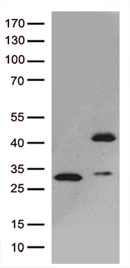 GIPC1 Antibody