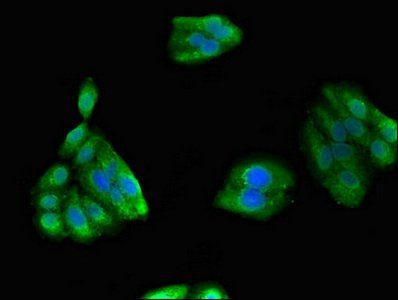 GIPC1 Antibody