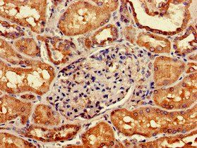 GIPC1 Antibody