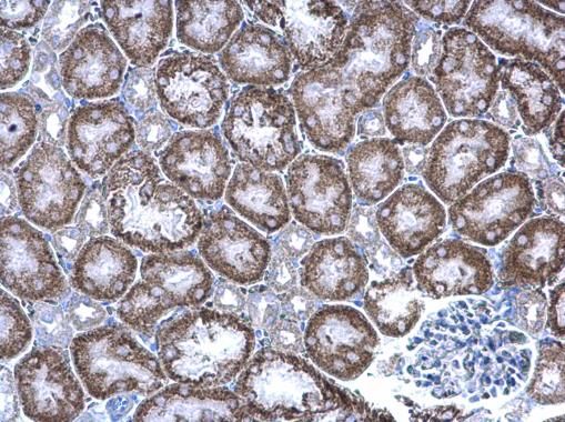 GIPC PDZ domain containing family member 1 Antibody