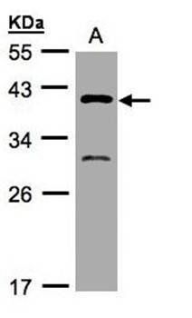 GIPC3 Rabbit Polyclonal Antibody