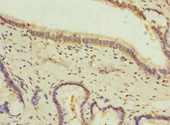 GIPR Antibody
