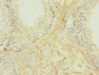 GIPR Antibody