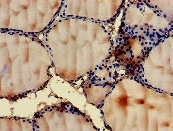 GIT1 Antibody