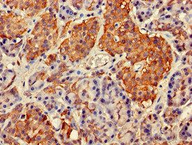 GIT1 Antibody