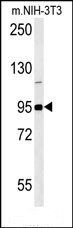 GIT1-Y554 antibody