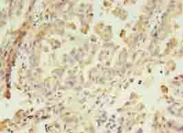 GIT2 Antibody