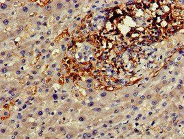 GJA8 Antibody