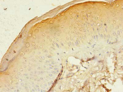 GJB3 Antibody