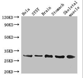 GJB3 antibody