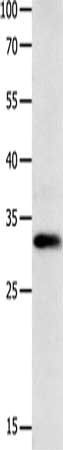 GJB3 antibody