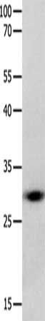 GJB3 antibody