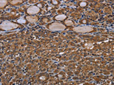 GJB4 Antibody