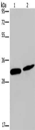 GJB4 antibody