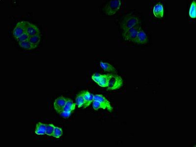 GJB6 Antibody