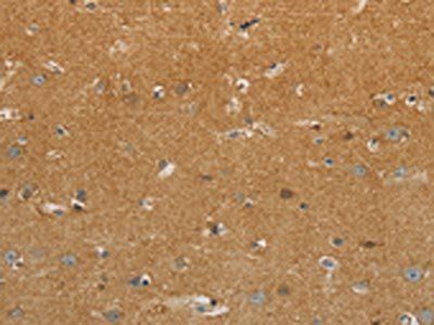 GJB6 Antibody