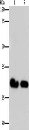 GJB6 antibody