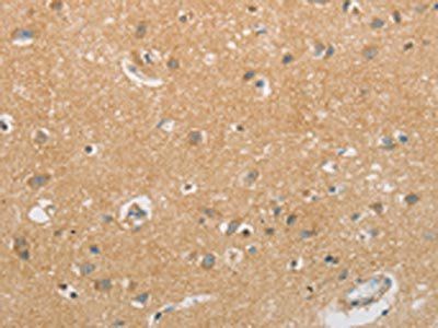 GJB6 Antibody
