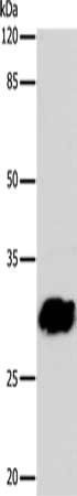 GJB6 antibody