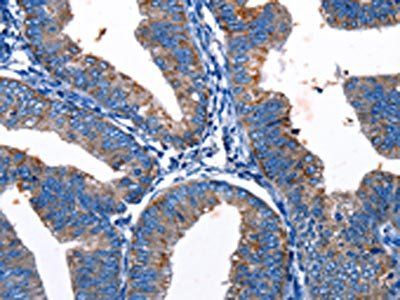 Gjc3 Antibody