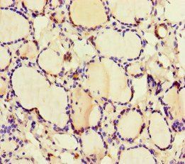GK Antibody
