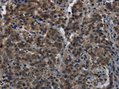 GK Antibody