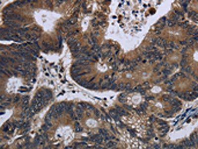 GK Antibody