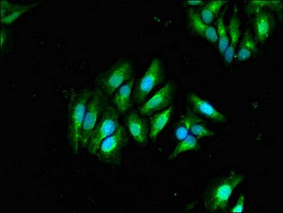 GLB1 Antibody