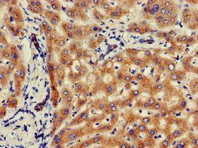 GLB1 Antibody