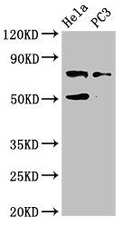 GLB1 Antibody