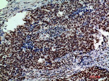 GLB1 Antibody