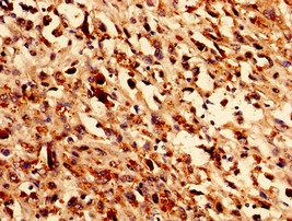 GLE1 Antibody