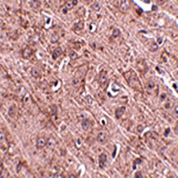 Gle1 Antibody