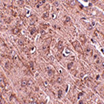 Gle1 Antibody