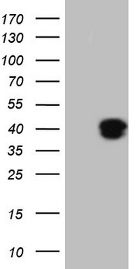 GLI1 Antibody