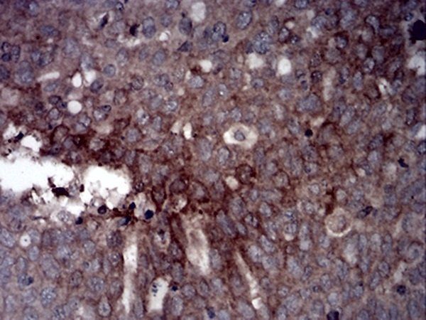 GLI1 Antibody