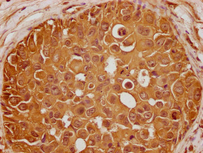 GLI2 Antibody